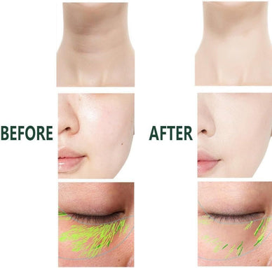 Transform Your Skin Today